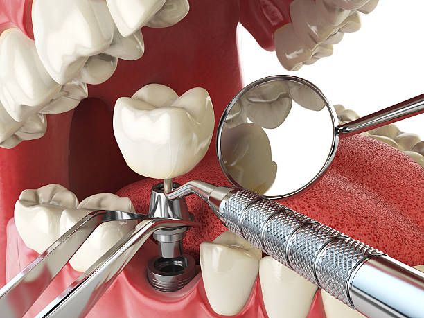 Best Emergency Treatment for Toothache in Welcome, SC